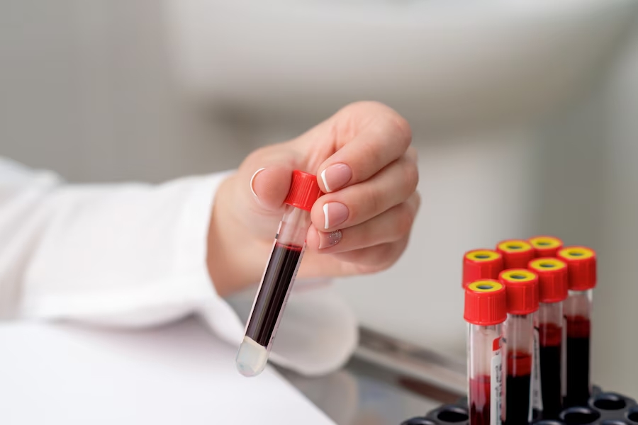 Bioscor-wellness-blood-test