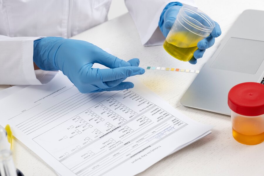 Bioscor-wellness-urine-test